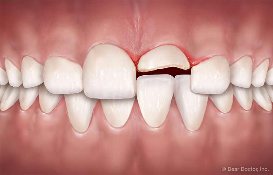 Prudency in oral injuries